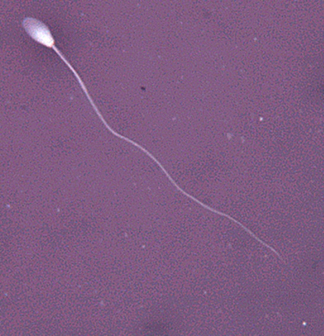 Sperm